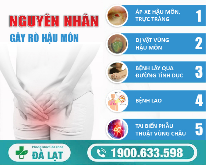 Hình ảnh minh họa